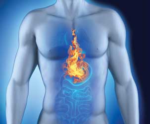 maag acid reflux heartburn