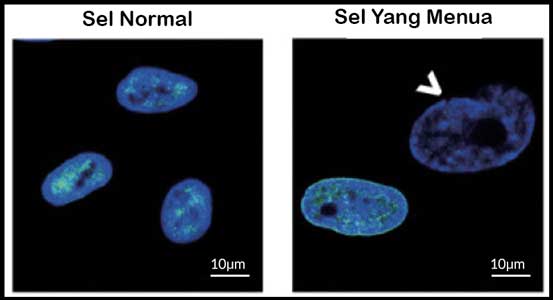 sel-sel yang menua