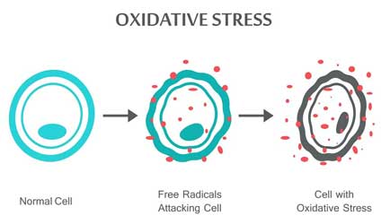 stress oksidatif radikal bebas