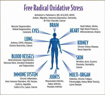 penyakit akibat stress oksidatif